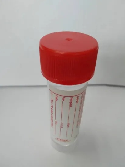 Universal 30ml Specimen Containers with Boric Acid
