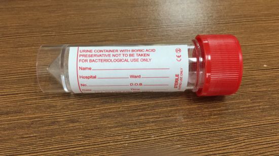 Universal Thirty Milliliter PS Specimen Containers with Boric Acid