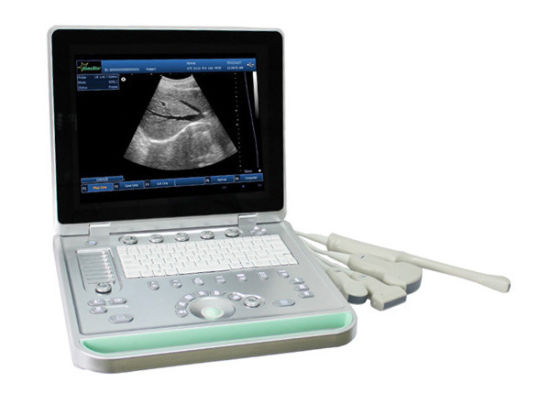 3D Laptop Color Doppler Portable Ultrasound with High Quality