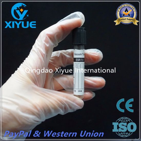 ESR Disposable Vacuum Blood Collection Tube with High Quality