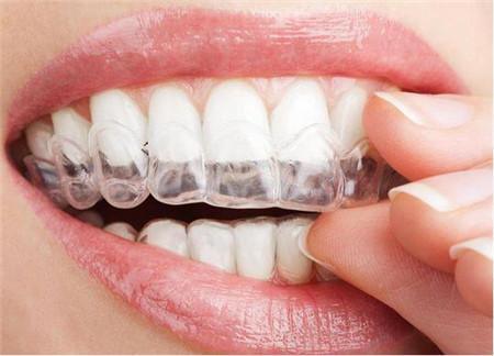 Silicone Soft Hard Retainer Teeth Straightening Corrector Dental Orthodontic Trainer