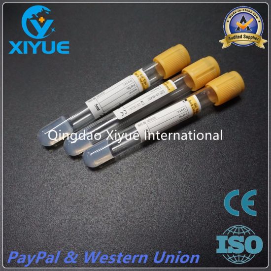 Medical Vacuum Blood Collection Tube with High Quality