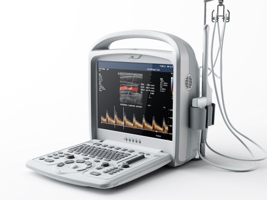 Full Digital Ultrasound Scanner with High Quality