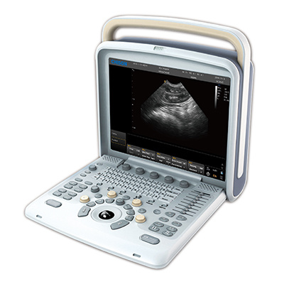 Full Digital Ultrasound Scanner with High Quality