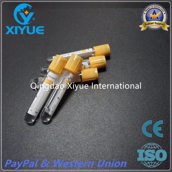 Medical Vacuum Blood Collection Tube with High Quality