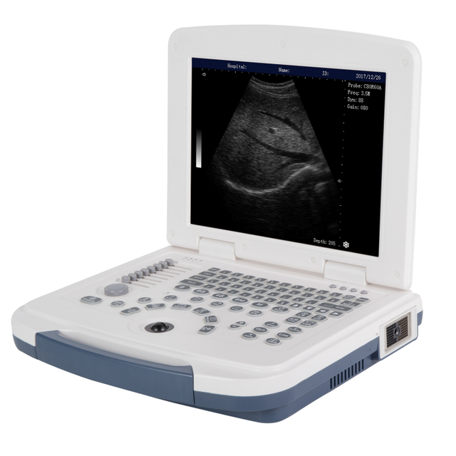 Ultrasound Machine Full Digital Ultrasonic Devices Ultrasound Diagnostic System