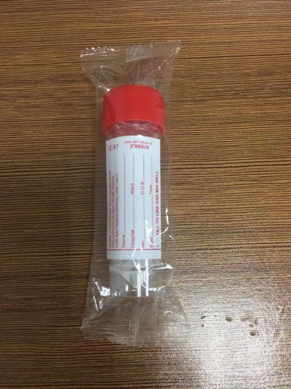 Universal Thirty Milliliter PS Specimen Containers with Boric Acid