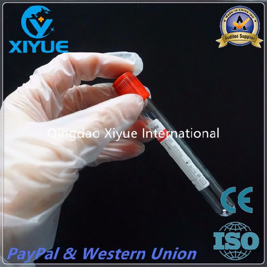 Ce & ISO Disposable Vacuum Blood Collection Clot Activator Tube with High Quality