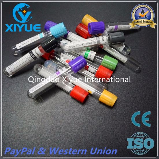 ESR Disposable Vacuum Blood Collection Tube with High Quality