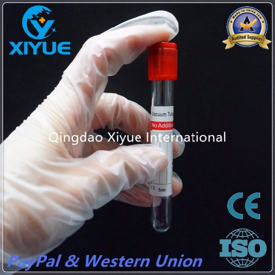 Ce & ISO Disposable Vacuum Blood Collection Clot Activator Tube with High Quality